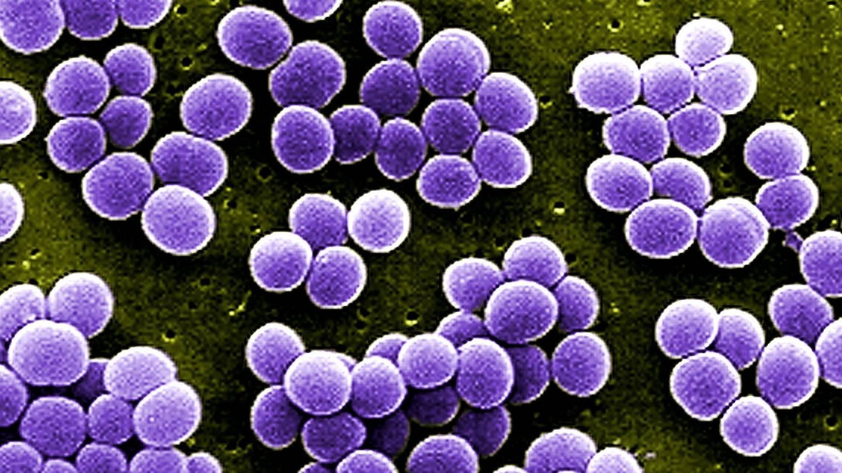 Staphylococcus aureus